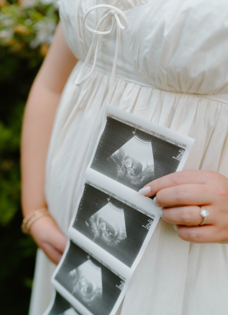 film photography maternity photoshoot with sonogram strip and picnic blanket